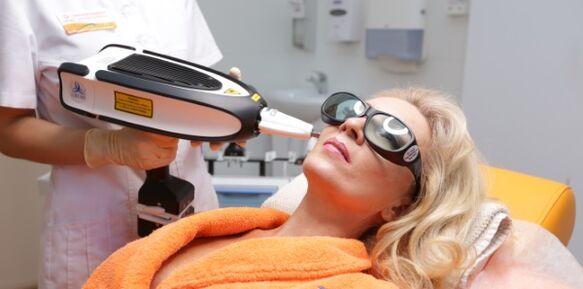 Lifting μετά από τριάντα χρόνια